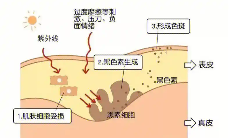 640 (1).png